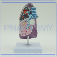 PNT-0732 Modèle pathologique des bronches pulmonaires, modèle biologique